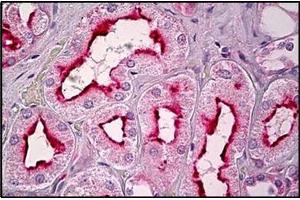 Human Kidney, Tubules: Formalin-Fixed, Paraffin-Embedded (FFPE) (GPR101 Antikörper  (C-Term))