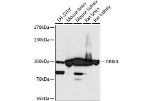 Western blot analysis of extracts of various cell lines, using GRIK4 antibody (ABIN6127977, ABIN6141396, ABIN6141397 and ABIN6217924) at 1:3000 dilution. (GRIK4 Antikörper  (AA 21-220))