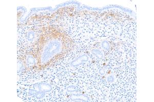 Immunohistochemistry (IHC) image for anti-Syndecan 1 (SDC1) (AA 23-251) antibody (ABIN7795739) (Rekombinanter Syndecan 1 Antikörper  (AA 23-251))