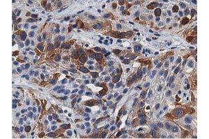 Image no. 2 for anti-Transforming, Acidic Coiled-Coil Containing Protein 3 (TACC3) antibody (ABIN1498095) (TACC3 Antikörper)