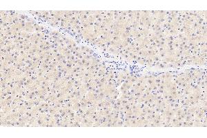 Detection of TYR in Porcine Liver Tissue using Polyclonal Antibody to Tyrosinase (TYR) (TYR Antikörper  (AA 5-245))