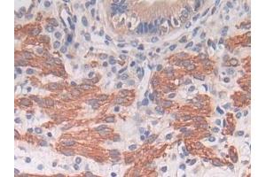 Immunohistochemistry (IHC) image for anti-Thioredoxin Interacting Protein (TXNIP) (AA 30-381) antibody (ABIN7433201)