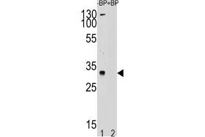 Western Blotting (WB) image for anti-Testis Specific Protein, Y-Linked 1 (TSPY1) antibody (ABIN2995165) (TSPY1 Antikörper)