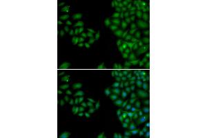 Immunofluorescence analysis of HeLa cells using NEFL antibody. (NEFL Antikörper)