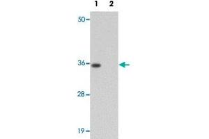 Western blot analysis of rat brain tissue with SYNGR1 polyclonal antibody  at 1 ug/mL in (Lane 1) the absence and (Lane 2) the presence of blocking peptide. (Synaptogyrin 1 Antikörper)