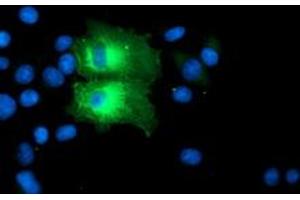 Anti-PFKP mouse monoclonal antibody (ABIN2455340) immunofluorescent staining of COS7 cells transiently transfected by pCMV6-ENTRY PFKP (RC200673). (PFKP Antikörper)