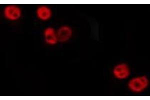 ABIN6275269 staining HepG2 by IF/ICC. (NACAD Antikörper  (N-Term))