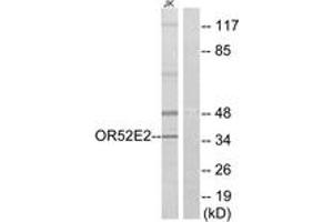 Western blot analysis of extracts from Jurkat cells, using OR52E2 Antibody.