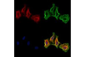 ABIN6266014 and ABIN6273185 staining Hela cells by IF/ICC. (WBP2NL Antikörper  (Internal Region))