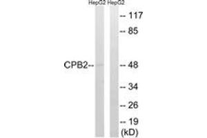 Western blot analysis of extracts from HepG2 cells, using CPB2 Antibody. (CPB2 Antikörper  (AA 321-370))