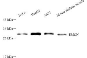 Western blot analysis of EMCN (ABIN7073818) at dilution of 1: 500 (Endomucin Antikörper)