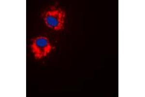 Immunofluorescent analysis of EG5 (pT926) staining in HepG2 cells.