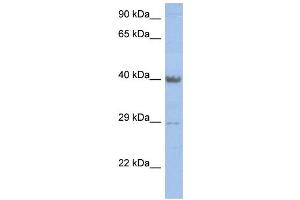 WB Suggested Anti-ZNF474 Antibody Titration: 0. (ZNF474 Antikörper  (Middle Region))