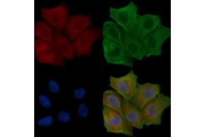 ABIN6258916 and ABIN6275149 staining Hela cells(24h of starvation treatment) by IF/ICC.