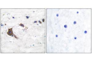 Immunohistochemistry (IHC) image for anti-Hydroxysteroid (17-Beta) Dehydrogenase 10 (HSD17B10) (Internal Region) antibody (ABIN1848526) (HSD17B10 Antikörper  (Internal Region))