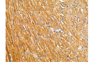 ABIN6257944 and ABIN6274861 at 1/100 staining Rat heart tissue by IHC-P. (ARFIP1 Antikörper  (Internal Region))
