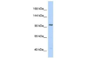 Western Blot showing IDE antibody used at a concentration of 1. (IDE Antikörper  (N-Term))