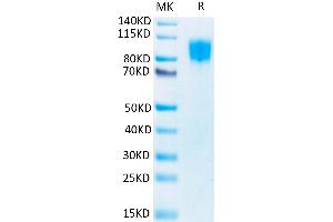 PDGFRB Protein (His-Avi Tag,Biotin)