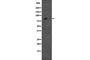 Western blot analysis of CDH12 expression in Jurkat cell lysate,The lane on the left is treated with the antigen-specific peptide. (Cadherin 12 Antikörper  (Internal Region))