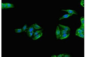 Immunofluorescent analysis of HepG2 cells using ABIN7172328 at dilution of 1:100 and Alexa Fluor 488-congugated AffiniPure Goat Anti-Rabbit IgG(H+L) (TANK Antikörper  (AA 4-98))