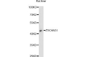 Western blot analysis of extracts of rat liver, using ZSCAN31 antibody (ABIN6294106) at 1:3000 dilution.
