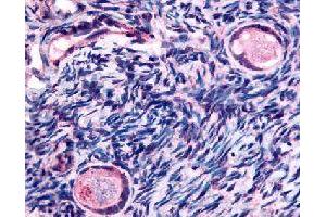 Immunohistochemical (Formalin/PFA-fixed paraffin-embedded sections) staining in human ovary (oocytes) with TMEM5 polyclonal antibody . (TMEM5 Antikörper)