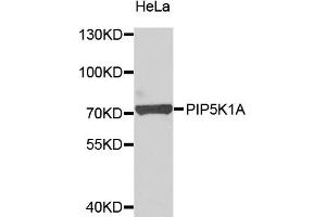 Western blot analysis of extracts of HeLa cells, using PIP5K1A antibody.