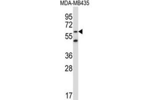 Western Blotting (WB) image for anti-Zinc Finger Protein 479 (ZNF479) antibody (ABIN5017203) (ZNF479 Antikörper)