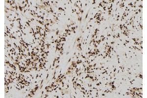 ABIN6272431 at 1/100 staining Human gastric tissue by IHC-P. (SIN3B Antikörper  (Internal Region))