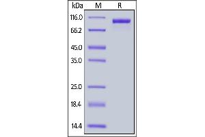 Fed Human ErbB3, His Tag on  under reducing (R) condition.