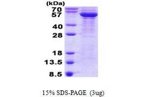 Image no. 1 for Tubulin, beta 3 (TUBB3) protein (His tag) (ABIN1098562) (TUBB3 Protein (His tag))
