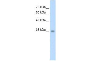 WB Suggested Anti-PP2447 Antibody Titration:  2. (TRABD Antikörper  (N-Term))