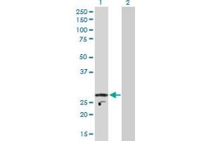 Western Blot analysis of KCNIP2 expression in transfected 293T cell line by KCNIP2 MaxPab polyclonal antibody.