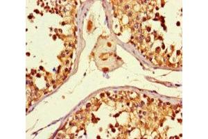 Immunohistochemistry of paraffin-embedded human testis tissue using ABIN7160774 at dilution of 1:100 (SMYD2A Antikörper  (AA 115-272))