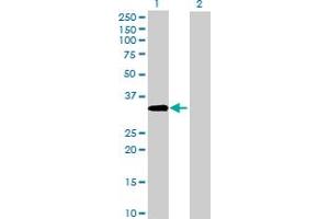 Western Blot analysis of ACBD4 expression in transfected 293T cell line by ACBD4 MaxPab polyclonal antibody. (ACBD4 Antikörper  (AA 1-305))