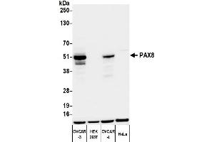 Western Blotting (WB) image for anti-Paired Box 8 (PAX8) (AA 225-275) antibody (ABIN7795777) (Rekombinanter PAX8 Antikörper  (AA 225-275))