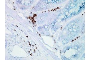 Immunohistochemistry analysis using Mouse Anti-Hsp70 Monoclonal Antibody, Clone BB70 (ABIN361709 and ABIN361710). (HSP70/HSC70 Antikörper)