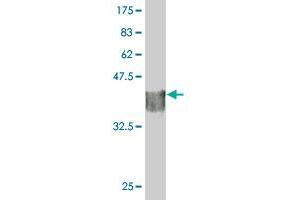 Western Blot detection against Immunogen (35. (STK40 Antikörper  (AA 349-434))