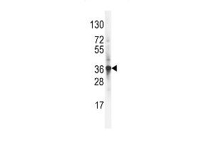 Western blot analysis of LDLR Antibody (C-term) (ABIN392554 and ABIN2842101) in NCI- cell line lysates (35 μg/lane). (LDLRAP1 Antikörper  (C-Term))