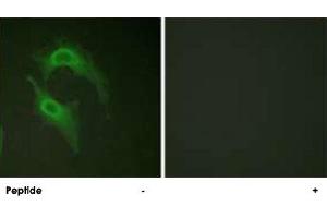 Immunofluorescence analysis of HeLa cells, using CD226 polyclonal antibody . (CD226 Antikörper  (Ser329))