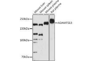 Western blot analysis of extracts of various cell lines, using  antibody (ABIN7265440) at 1:1000 dilution. (ADAMTS13 Antikörper)