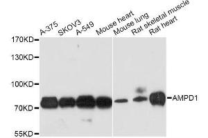 Western blot analysis of extracts of various cell lines, using AMPD1 antibody. (AMPD1 Antikörper  (AA 50-260))