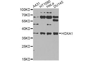 Western blot analysis of extracts of various cell lines, using HOXA1 antibody (ABIN2563217) at 1:1000 dilution. (HOXA1 Antikörper)