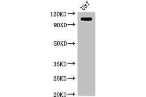 Western Blot Positive WB detected in: U87 whole cell lysate All lanes: HK2 antibody at 4 μg/mL Secondary Goat polyclonal to rabbit IgG at 1/50000 dilution Predicted band size: 103 kDa Observed band size: 103 kDa (Hexokinase 2 Antikörper  (AA 334-526))