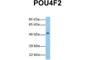Host:  Rabbit  Target Name:  POU4F2  Sample Tissue:  Human Fetal Liver  Antibody Dilution:  1.