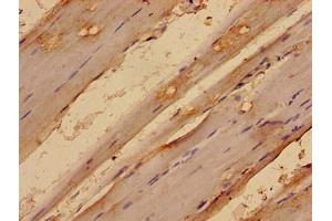 Immunohistochemistry analysis of human skeletal muscle tissue using ABIN7159132 at dilution of 1:100 (MED24 Antikörper  (AA 1-300))
