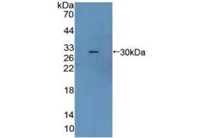 Detection of Recombinant CBR1, Mouse using Polyclonal Antibody to Carbonyl Reductase 1 (CBR1) (CBR1 Antikörper  (AA 66-271))