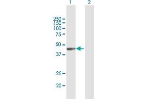 Western Blot analysis of MICB expression in transfected 293T cell line by MICB MaxPab polyclonal antibody. (MICB Antikörper  (AA 1-340))