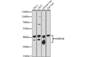 Western blot analysis of extracts of various cell lines, using HNRPAB antibody (ABIN7267625) at 1:1000 dilution. (HNRNPAB Antikörper  (AA 1-285))