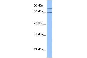 OXCT2 antibody used at 1 ug/ml to detect target protein. (OXCT2 Antikörper  (Middle Region))